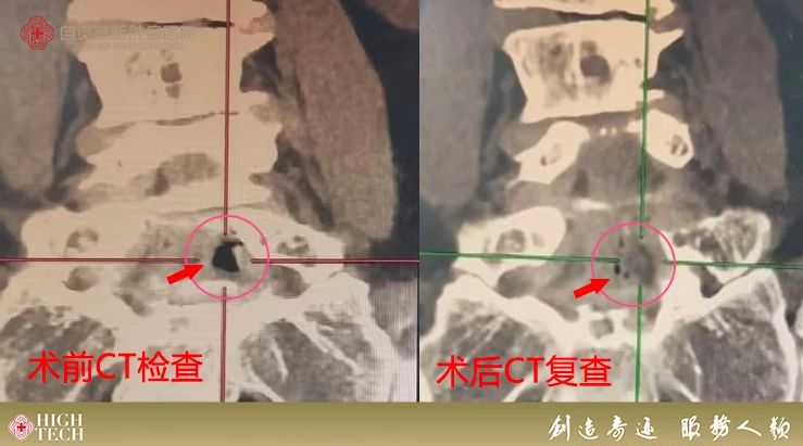 腳痛、坐立不安？這項治療可以助你恢復(fù)活力