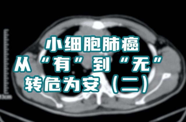 小細(xì)胞肺癌患者，縱隔淋巴結(jié)腫大，情況危急。通過(guò)介入綜合治療，病灶已基本消失